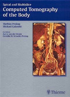 Portada del libro 9783131164810 Spiral and Multislice Computed Tomography of the Body