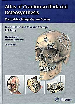 Portada del libro 9783131164926 Atlas of Craniomaxillofacial Osteosynthesis. Microplates, Miniplates, and Screws