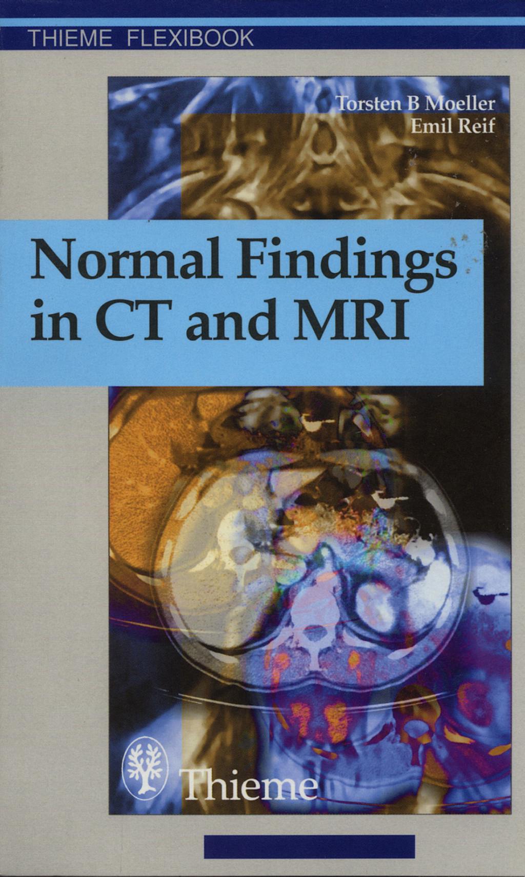 Portada del libro 9783131165213 Normal Findings in Ct and Mri