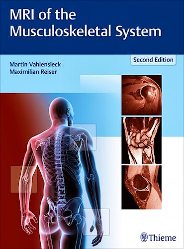 Portada del libro 9783131165725 MRI of the Musculoskeletal System