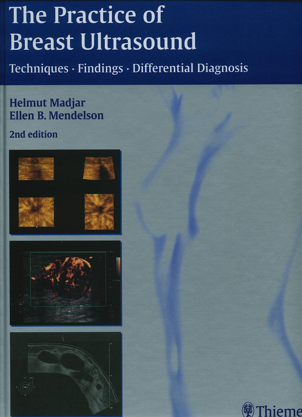 Portada del libro 9783131243423 Practice of Breast Ultrasound. Techniques - Findings - Differential Diagnosis