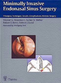 Portada del libro 9783131246110 Minimally Invasive Endonasal Sinus Surgery
