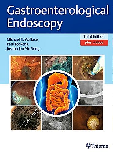 Portada del libro 9783131258533 Gastroenterological Endoscopy