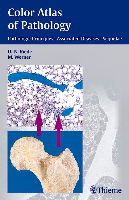 Portada del libro 9783131277817 Color Atlas of Pathology