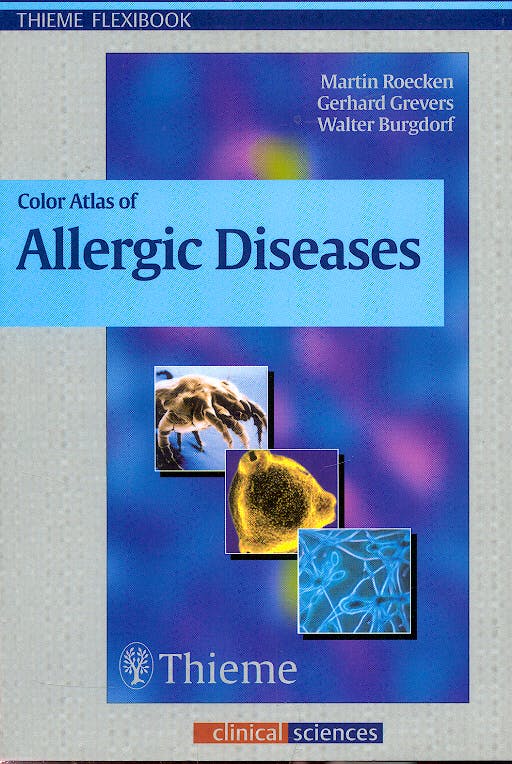 Portada del libro 9783131291912 Color Atlas of Allergic Diseases