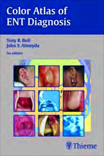Portada del libro 9783131293954 Color Atlas of Ent Diagnosis