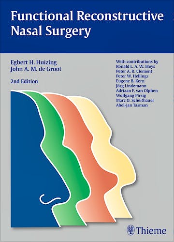 Portada del libro 9783131294128 Functional Reconstructive Nasal Surgery