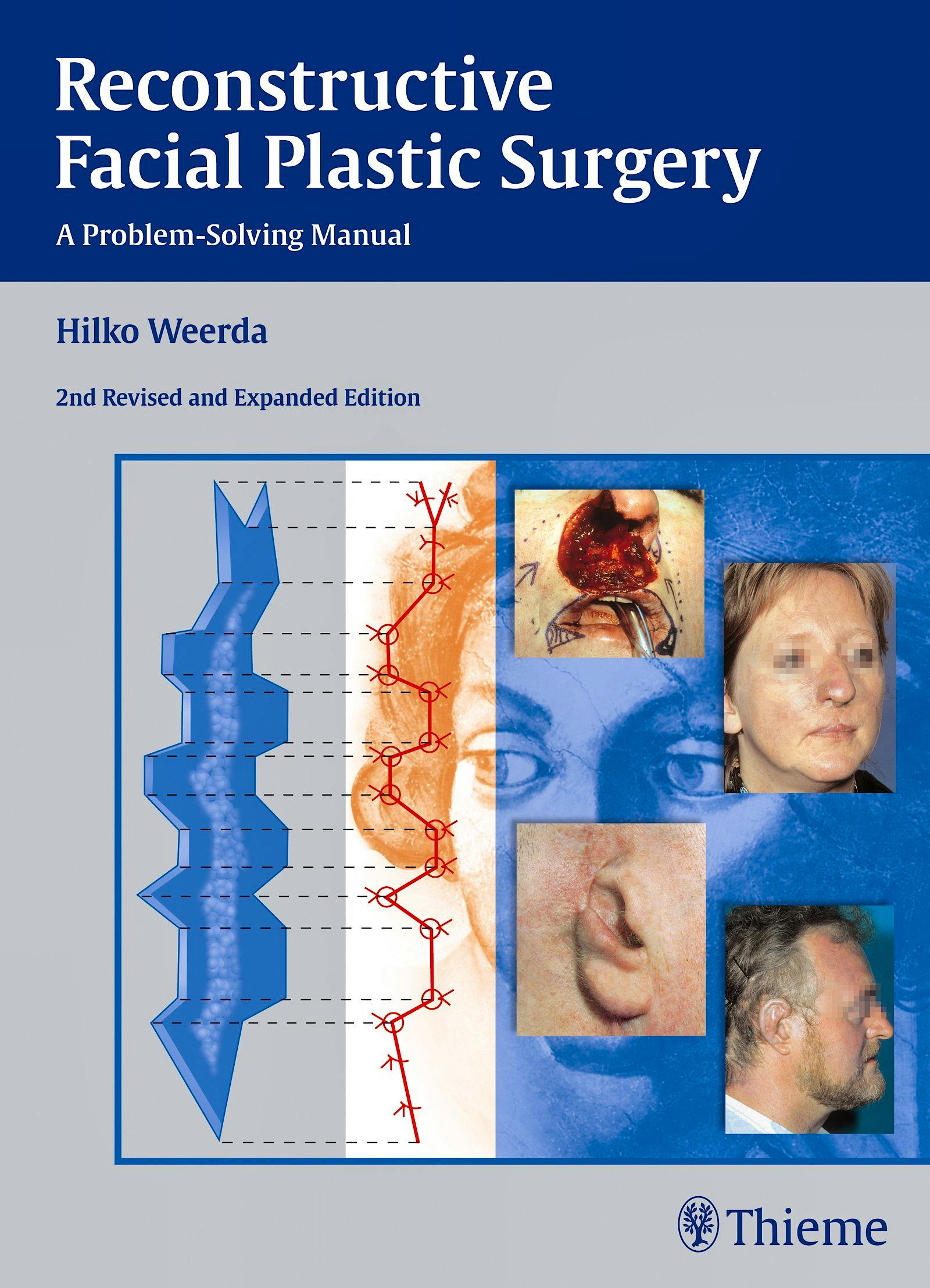 Portada del libro 9783131296429 Reconstructive Facial Plastic Surgery. a Problem-Solving Manual