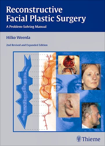 Portada del libro 9783131296429 Reconstructive Facial Plastic Surgery. a Problem-Solving Manual