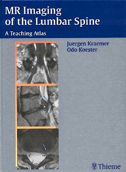 Portada del libro 9783131300911 Mr Imaging of the Lumbar Spine