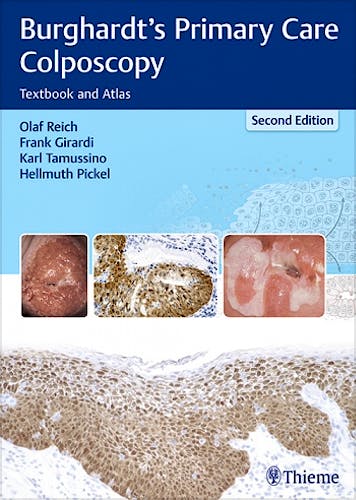 Portada del libro 9783131307224 Burghardt's Primary Care Colposcopy. Textbook and Atlas