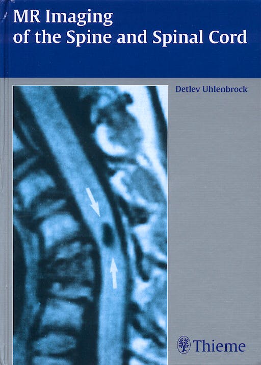 Portada del libro 9783131309419 Mr Imaging of the Spine and Spinal Cord