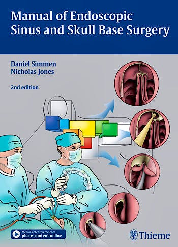 Portada del libro 9783131309723 Manual of Endoscopic Sinus and Skull Base Surgery