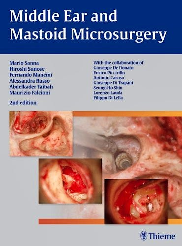 Portada del libro 9783131320926 Middle Ear and Mastoid Microsurgery