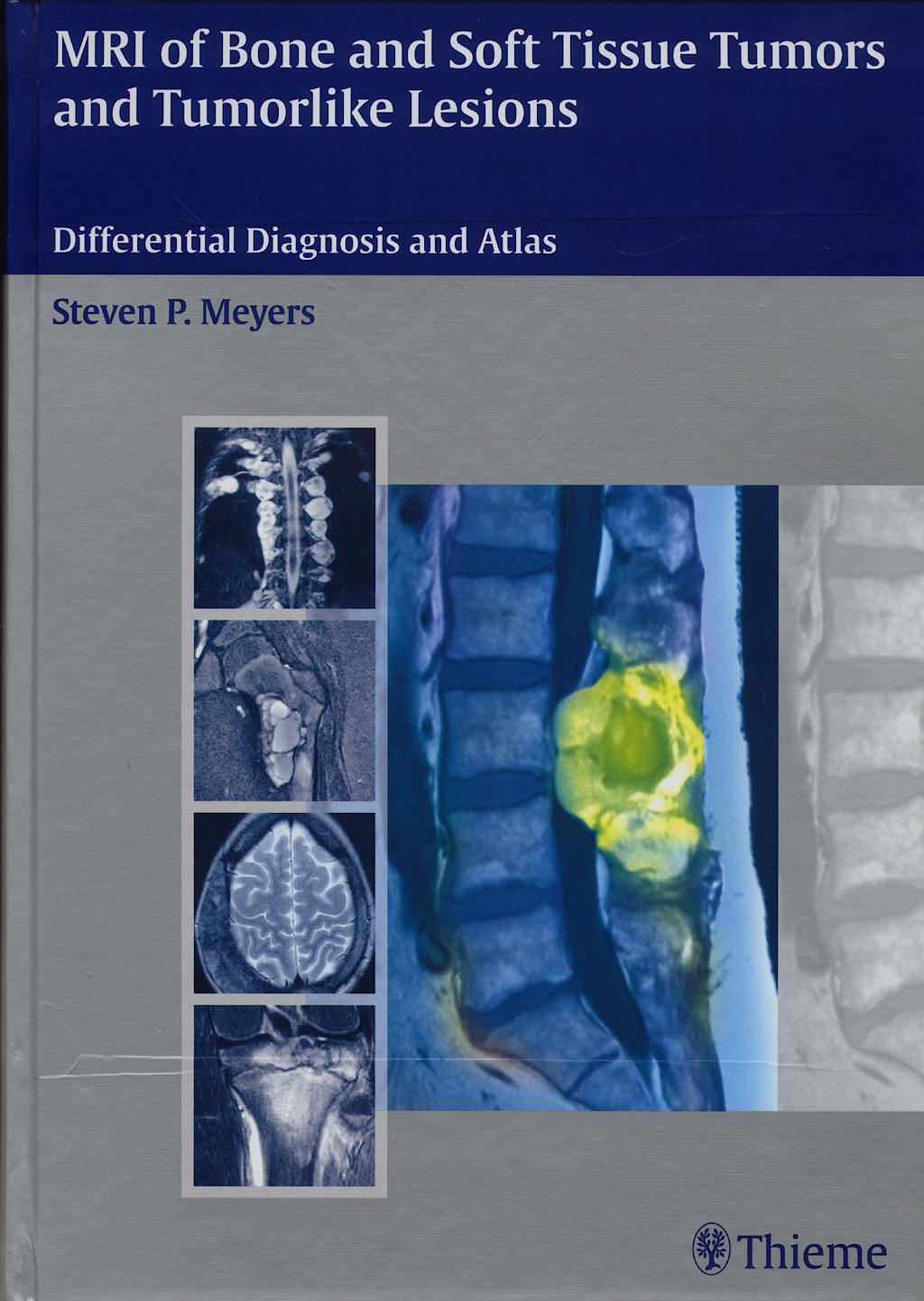 Portada del libro 9783131354211 Mri of Bone and Soft Tissue Tumors and Tumorlike Lesions. Differential Diagnosis and Atlas