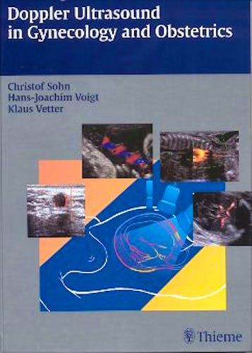 Portada del libro 9783131355911 Doppler Ultrasound in Gynaecology and Obstetrics