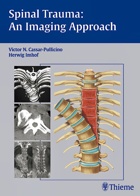 Portada del libro 9783131374714 Spinal Trauma: An Imaging Approach
