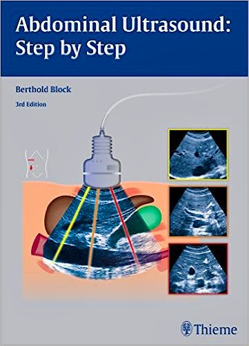 Portada del libro 9783131383631 Abdominal Ultrasound: Step by Step