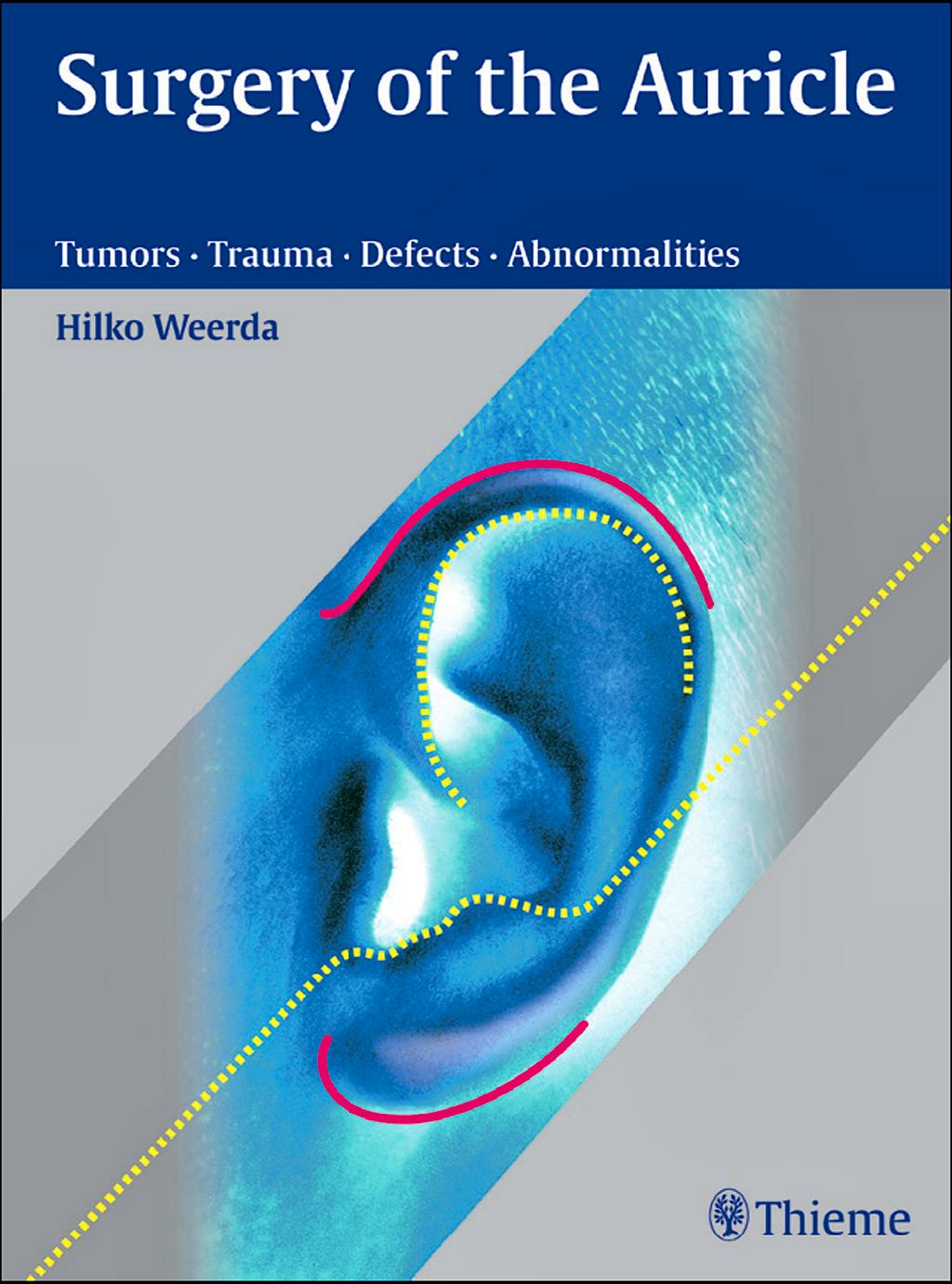 Portada del libro 9783131394118 Surgery of the Auricle. Tumors · Trauma · Defects · Abnormalities