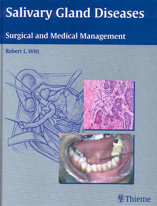 Portada del libro 9783131396112 Salivary Gland Diseases. Surgical and Medical Management
