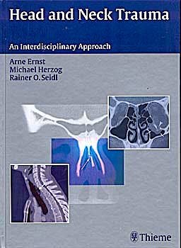 Portada del libro 9783131400017 Head and Neck Trauma. an Interdisciplinary Approach