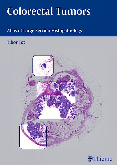 Portada del libro 9783131405913 Colorectal Tumors