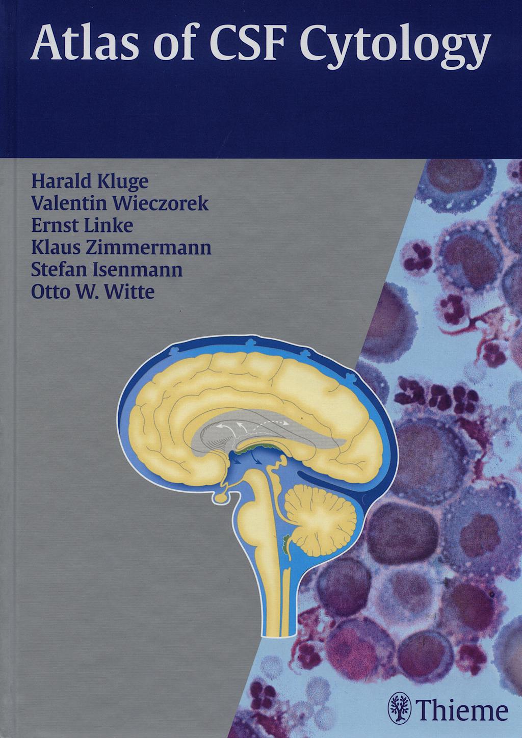 Portada del libro 9783131431615 Atlas of Csf Cytology