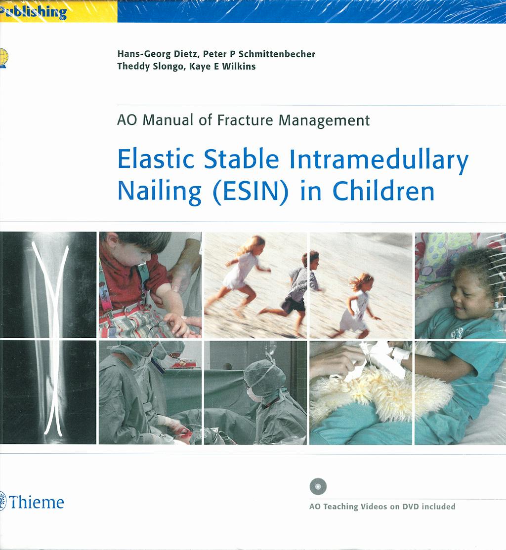 Portada del libro 9783131433312 Elastic Stable Intramedullary Nailing (Esin) in Children