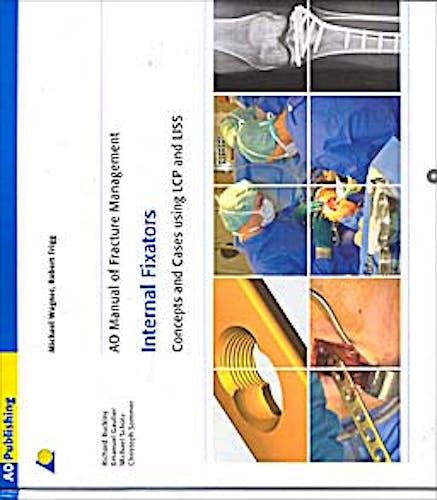 Portada del libro 9783131435514 AO Manual of Fracture Management. Internal Fixators. Concepts and Cases Using Lcp and Liss