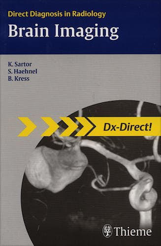 Portada del libro 9783131439611 Brain Imaging. Direct Diagnosis in Radiology