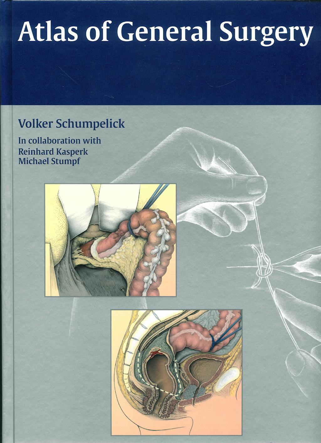 Portada del libro 9783131440914 Atlas of General Surgery
