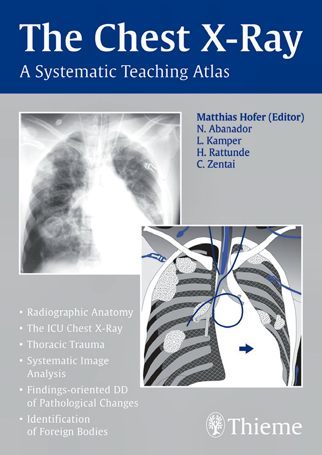 Portada del libro 9783131442116 The Chest X-Ray. a Systematic Teaching Atlas