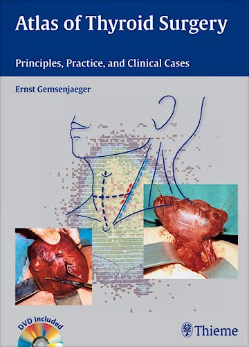 Portada del libro 9783131450319 Atlas of Thyroid Surgery. Principles, Practice, and Clinical Cases