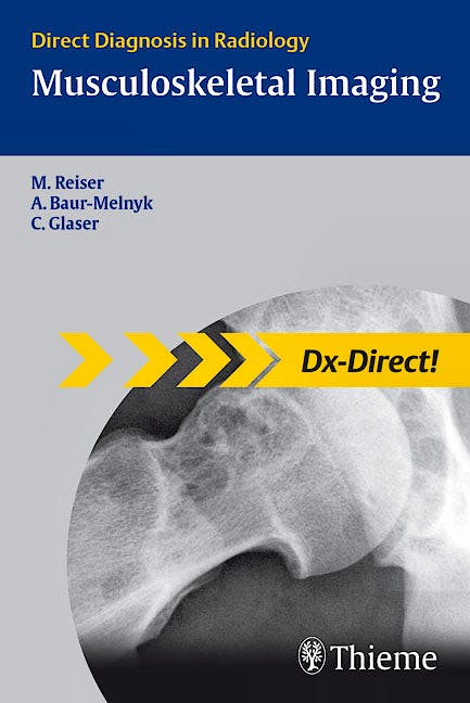 Portada del libro 9783131451613 Musculoskeletal Imaging