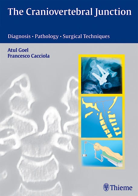 Portada del libro 9783131455819 The Craniovertebral Junction. Diagnosis - Pathology - Surgical Techniques