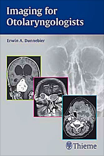 Portada del libro 9783131463319 Imaging for Otolaryngologists