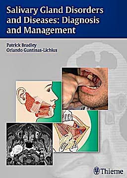 Portada del libro 9783131464910 Salivary Gland Disorders and Diseases: Diagnosis and Management
