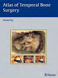 Portada del libro 9783131471512 Atlas of Temporal Bone Surgery