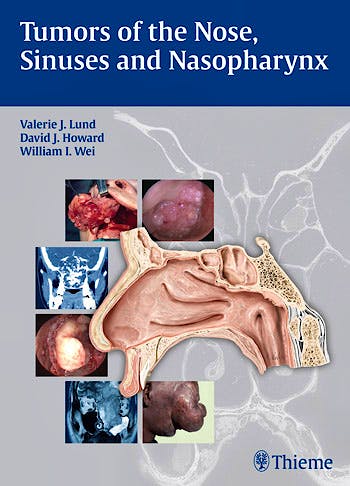 Portada del libro 9783131471918 Tumors of the Nose, Sinuses and Nasopharynx