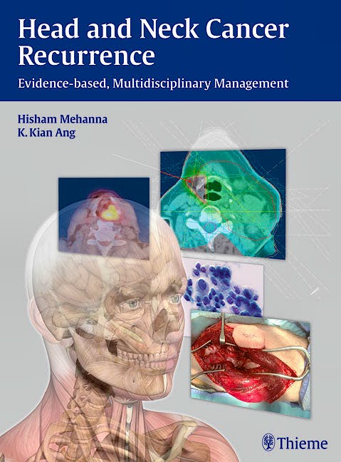Portada del libro 9783131473912 Head and Neck Cancer Recurrence. Evidence-Based, Multidisciplinary Management