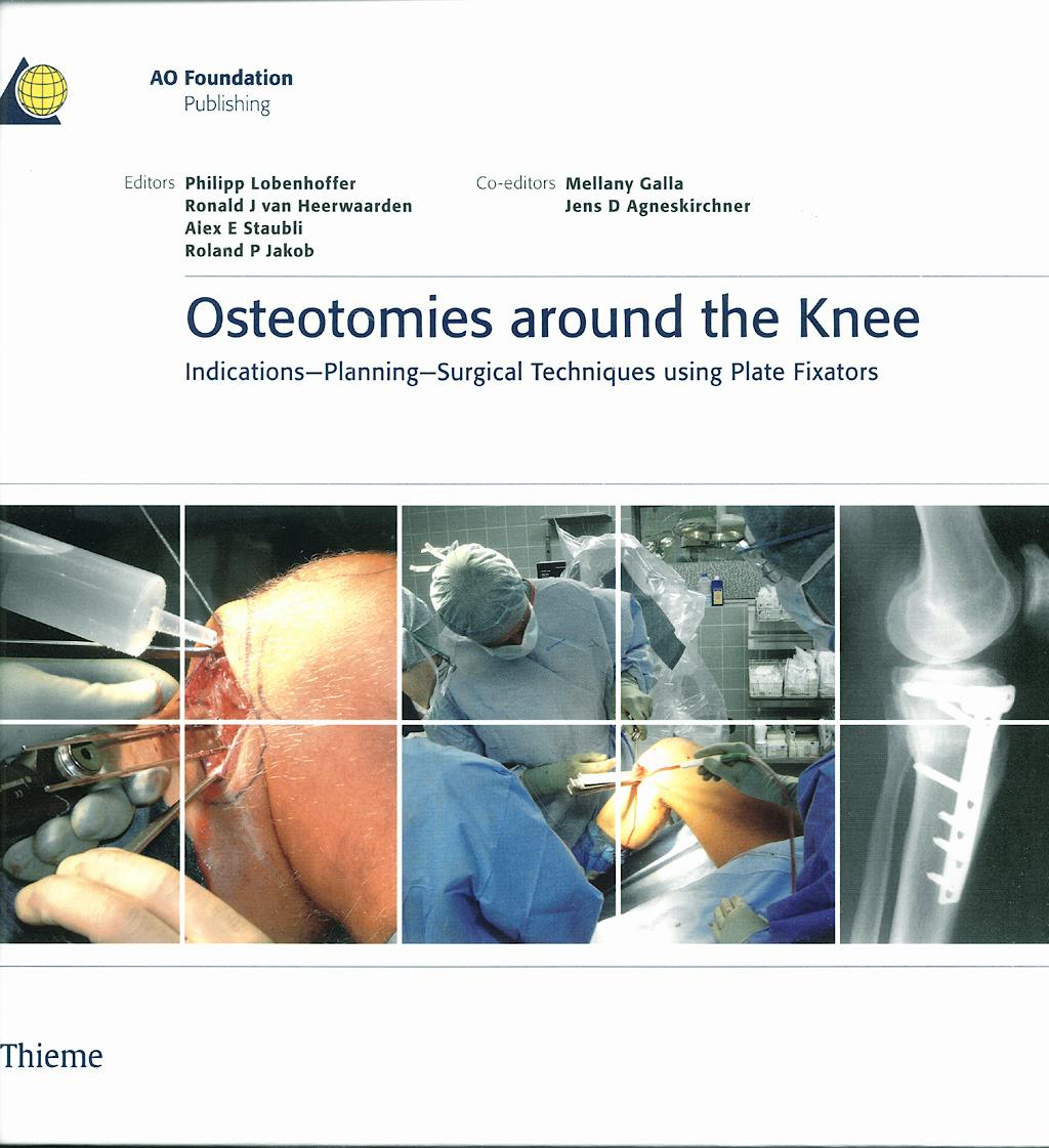 Portada del libro 9783131475312 Osteotomies around the Knee. Indication-Planning-Surgical Techniques Using Plate Fixators