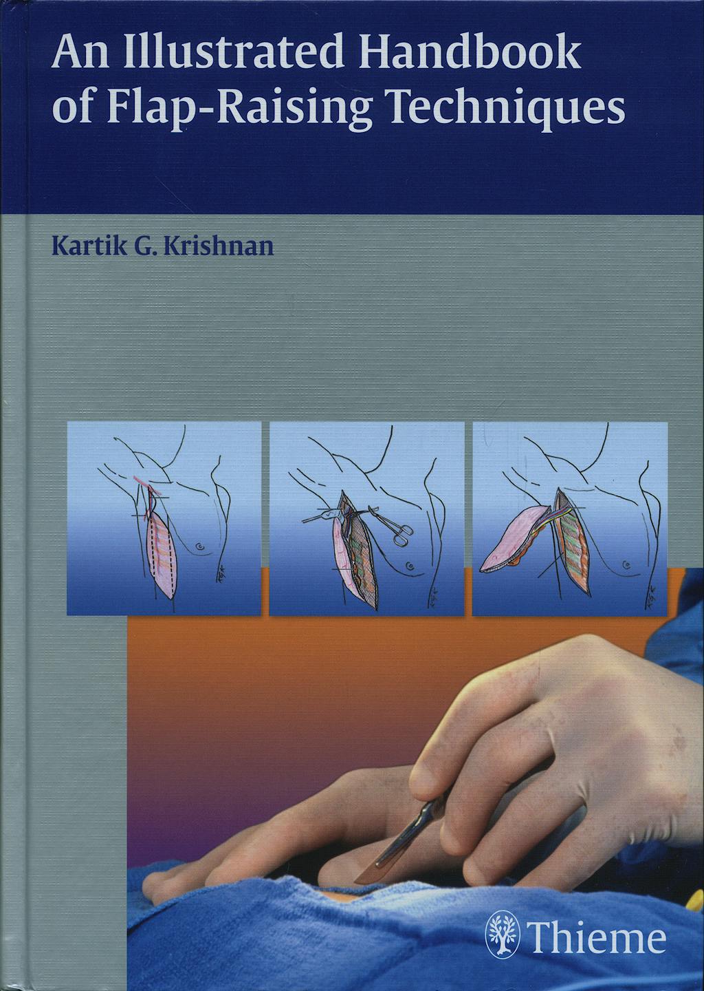 Portada del libro 9783131477613 An Illustrated Handbook of Flap-Raising Techniques