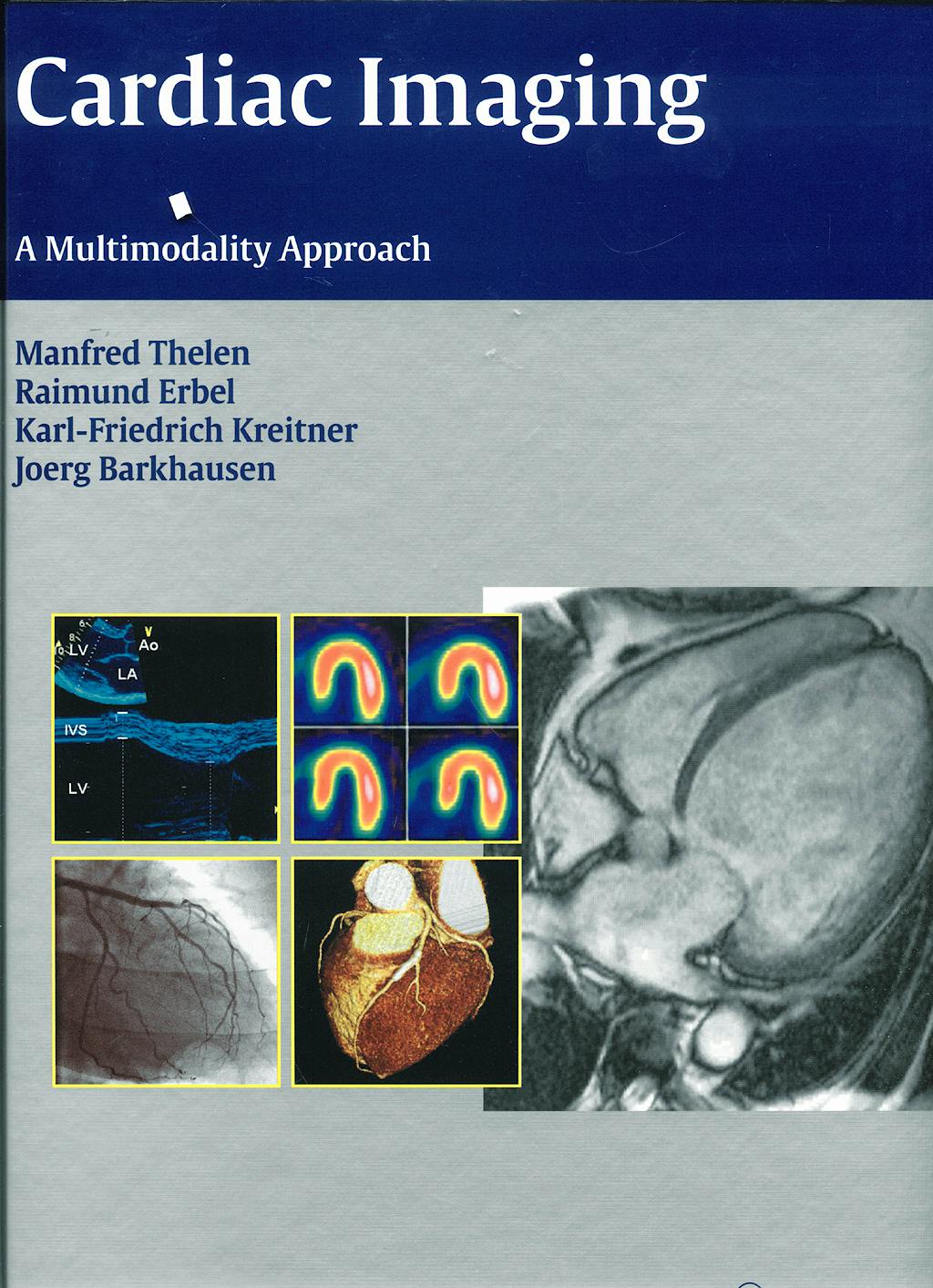 Portada del libro 9783131477811 Cardiac Imaging. a Multimodality Approach