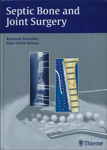 Portada del libro 9783131490315 Septic Bone and Joint Surgery