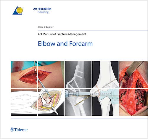 Portada del libro 9783131492715 AO Manual of Fracture Management. Elbow and Forearm