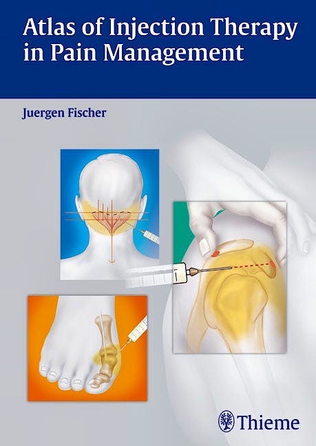Portada del libro 9783131543011 Atlas of Injection Therapy in Pain Management