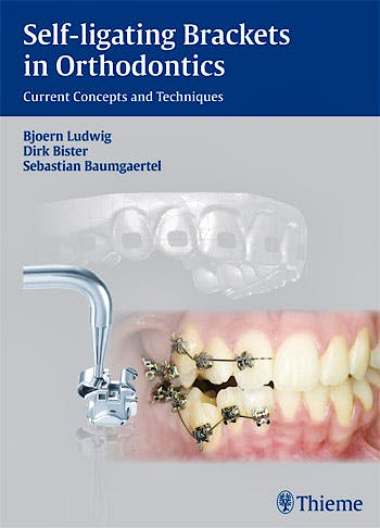 Portada del libro 9783131547019 Self-Ligating Brackets in Orthodontics. Current Concepts and Techniques