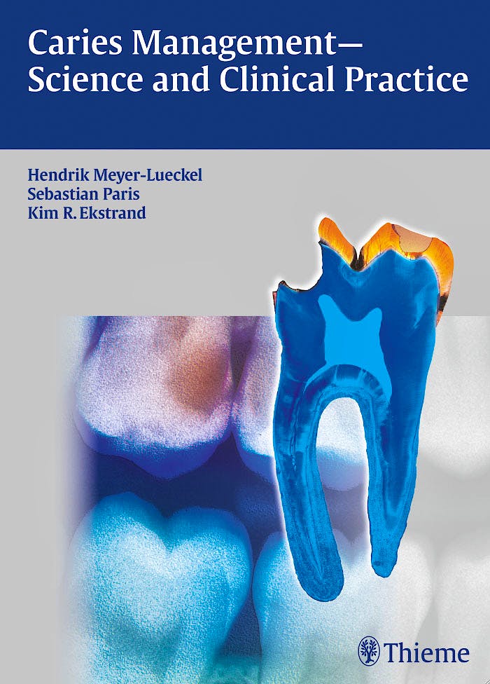 Portada del libro 9783131547118 Caries Management - Science and Clinical Practice