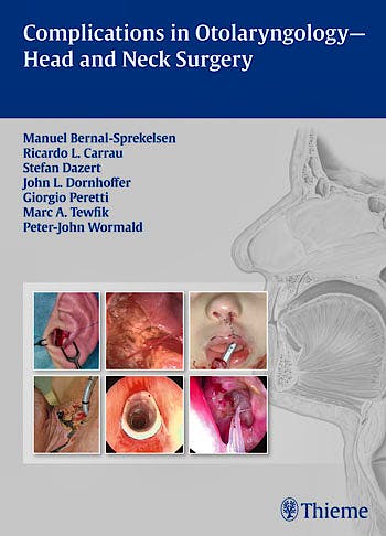 Portada del libro 9783131605313 Complications in Otolaryngology-Head and Neck Surgery
