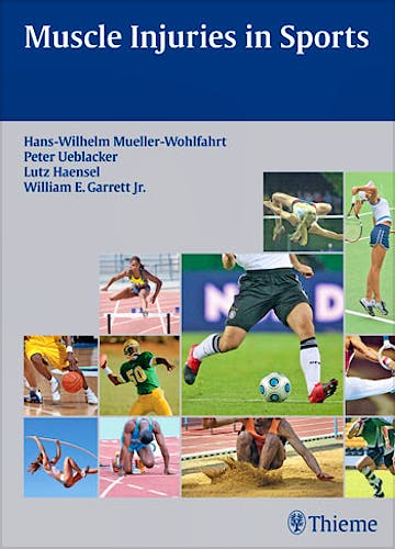 Portada del libro 9783131624710 Muscle Injuries in Sports